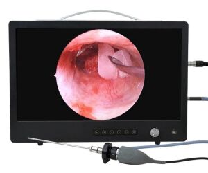 Full HD KBB Kamera Kombine – Endoskopik Görüntüleme Sistemi