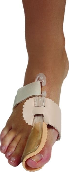 Hallux - Valgus Gece Ateli-Plastik