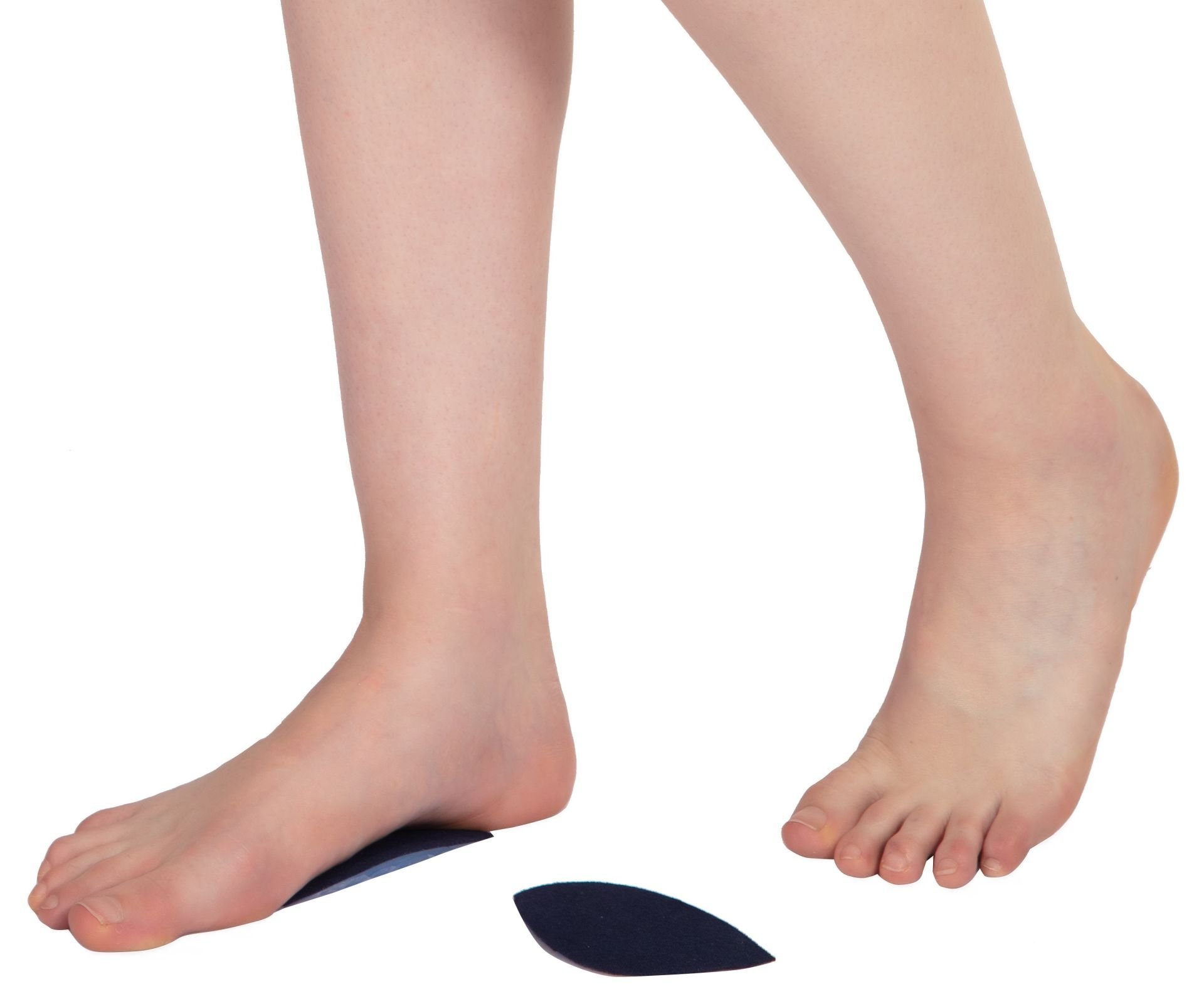 Silikon Yapışkanlı Ark Takviyesi